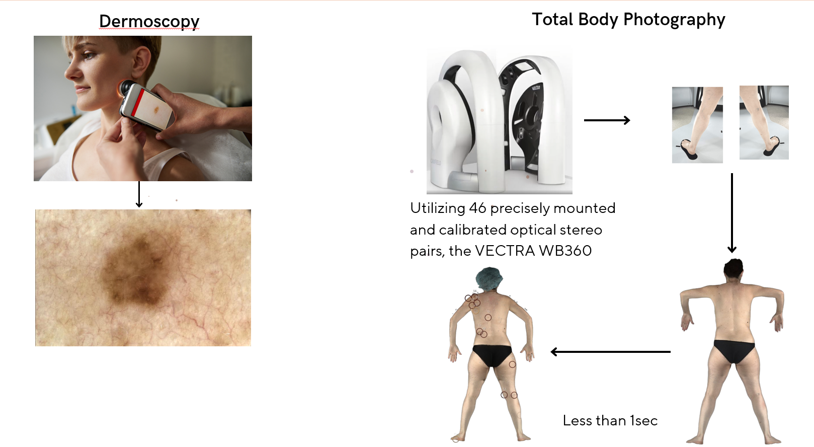 Dermoscopy vs Total Body Photography